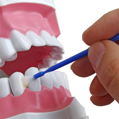 10 جرام 5٪ فلوريد NaF يطبق على الأسنان ويعيد التمعدن ويمنع التسوس